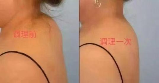 如何通过盘点打造清爽背部的5个秘诀？
