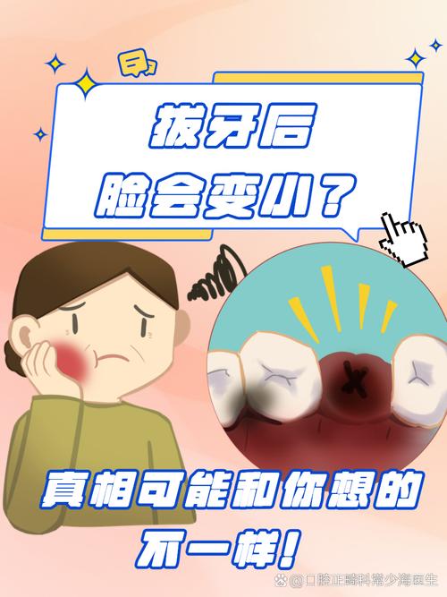 拔牙真的能瘦脸吗？小心小脸变瘪嘴有风险？