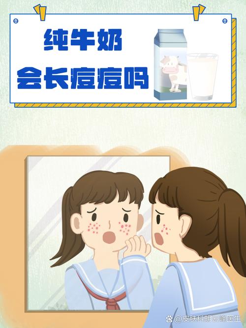 牛奶和含糖食物会导致长痘痘吗？