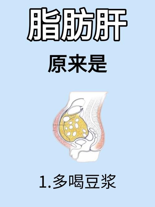 减肥过度会不会反而患上脂肪肝？