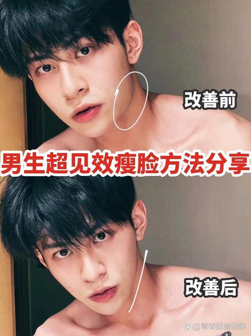 吸脂手术能否成为男性瘦脸的快速途径？