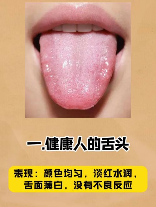 热炒舌苔减肥法真的靠谱吗？别被误导了！