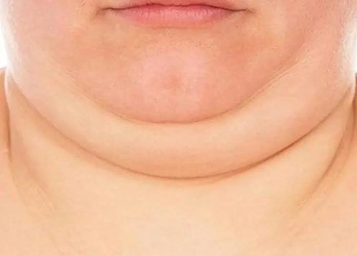 如何同过5个小技巧有效消除双下巴？
