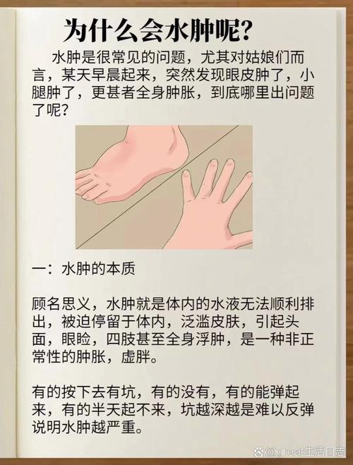 身体水肿的原因有哪些？你中招了吗？