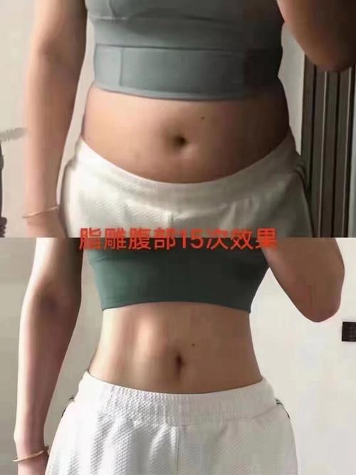 女性腹部脂肪真的那么重要，对健康和体型有什么忒别影响吗？