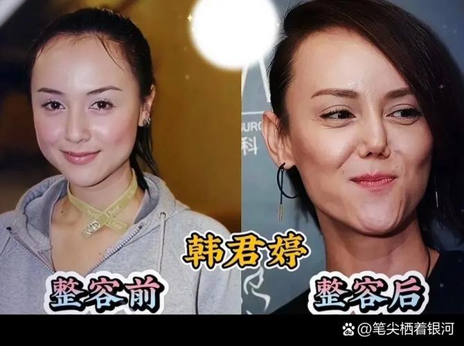 盘点大饼脸变锥子疑似整容的十大女星，她们真的整容了吗？