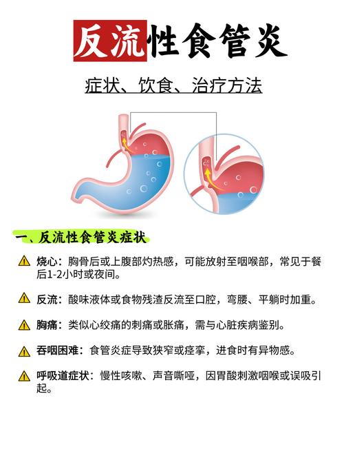 英国营养学家给出的对抗消化不良的9大建议是什么？