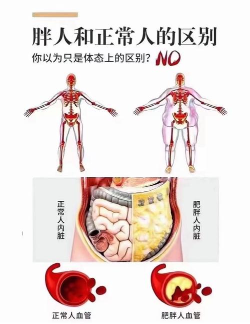 为什么肥胖现象在男性与女性之间存在显著差异？