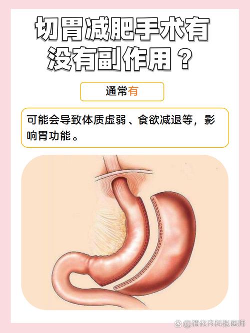 割胃手术真的能8个月减掉25公斤吗？专家提醒要慎重考虑？