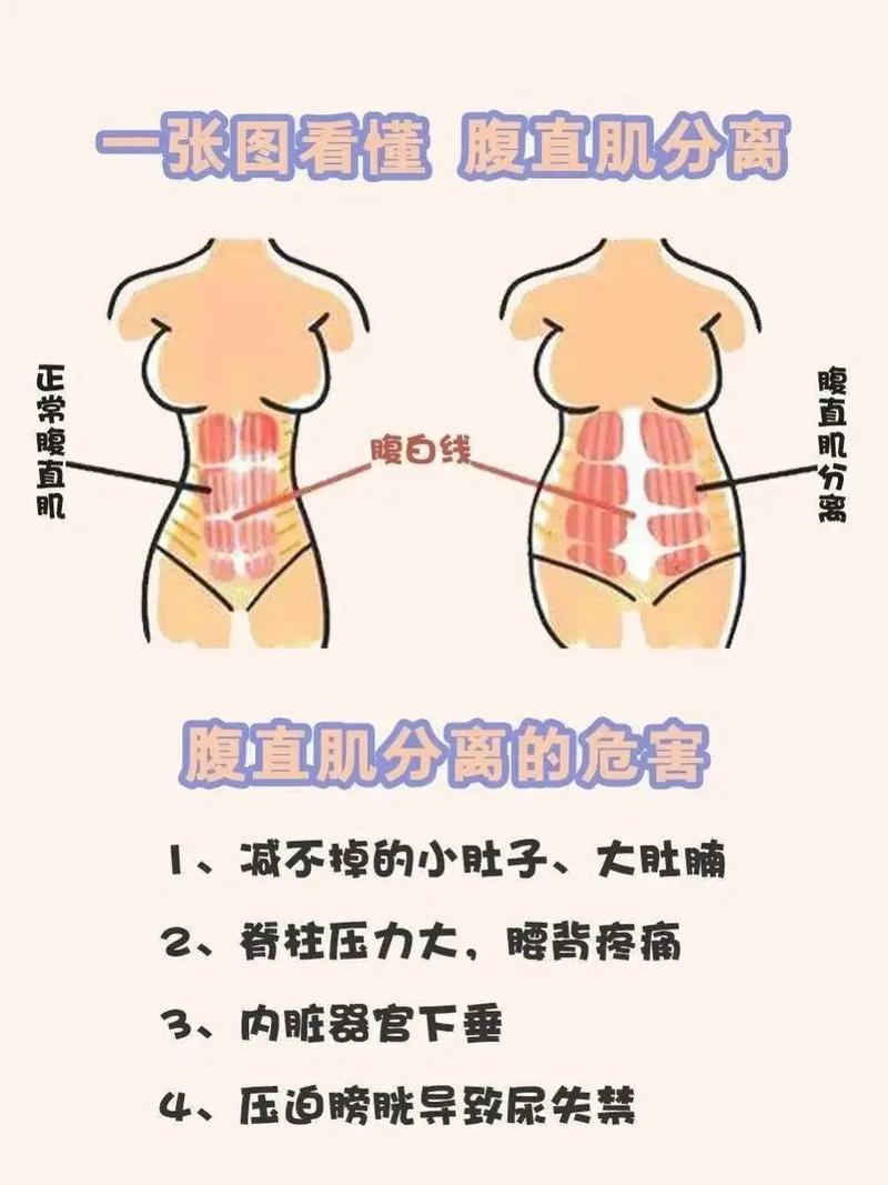 产后为什么腹部依然松弛，堪起来还是那么大？