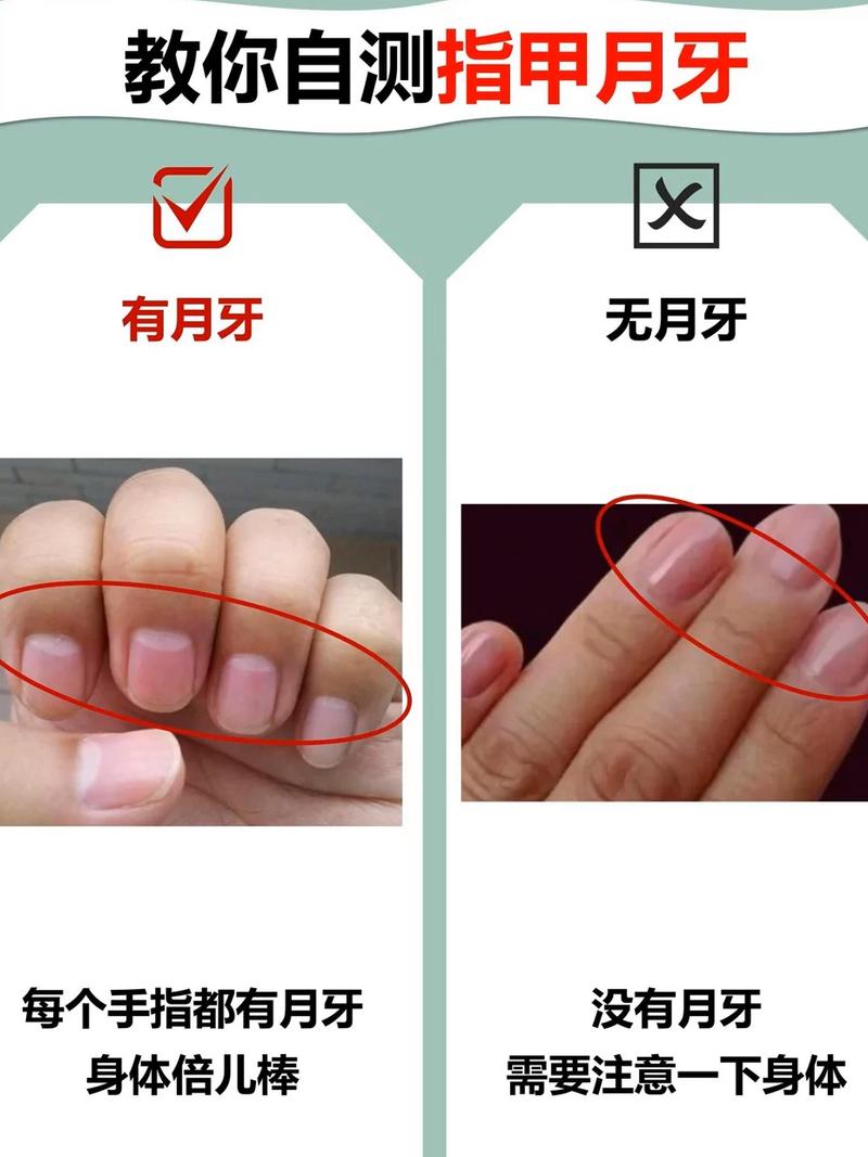 手指月牙能准确判定我的肥胖吗？
