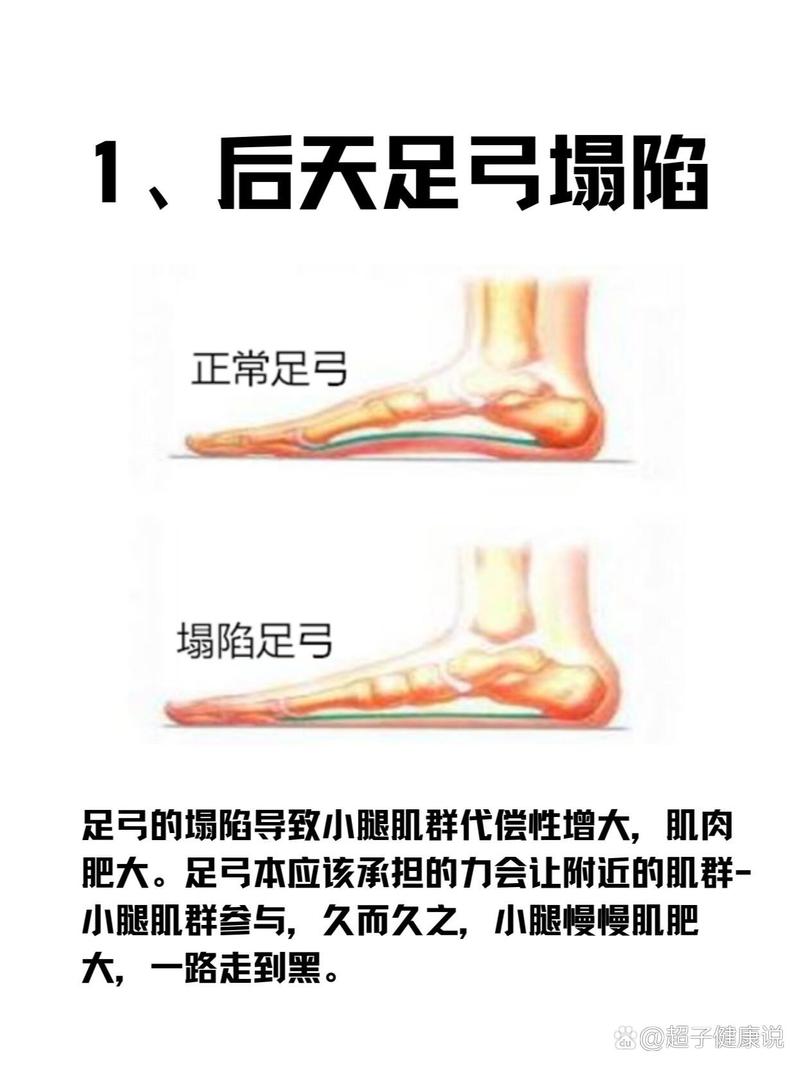 为什么我的腿部肌肉会逐渐变得粗壮？