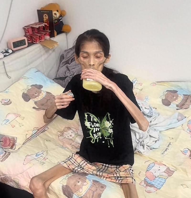 女子被甩后患厌食症，减重20公斤逆袭成选美冠军，这是怎么回事？