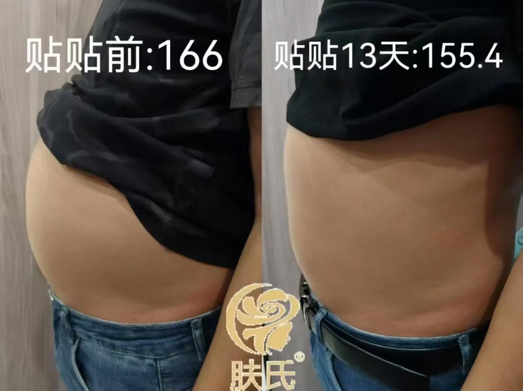 纤体产品如何有效消除浮肉？三个好方法推荐？
