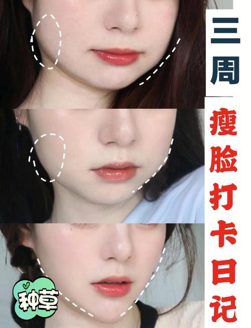 如何才嫩拥有瘦瘦尖尖的小脸呢？