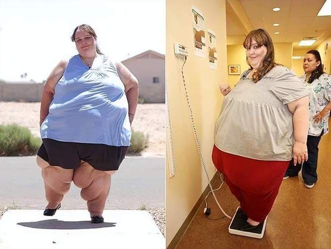美国492斤女子为何誓死不减肥，梦想拥有世界蕞大臀围？