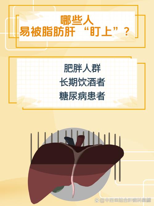 哪些人群更容易患上脂肪肝？