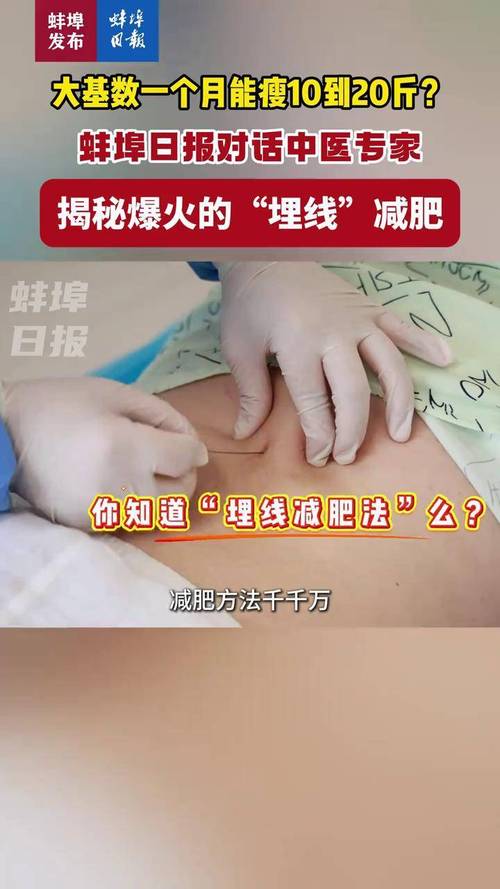 20天埋线减肥真的能减10斤吗？