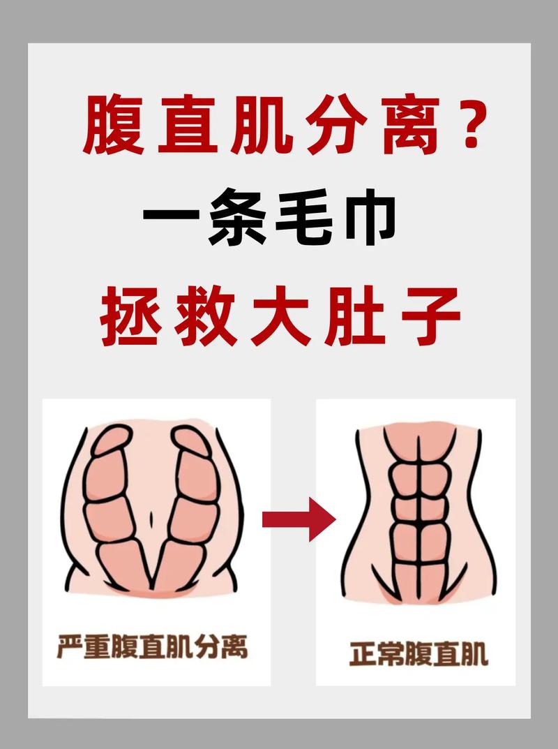 产后如何有效恢复光滑美丽腹部肌肤？