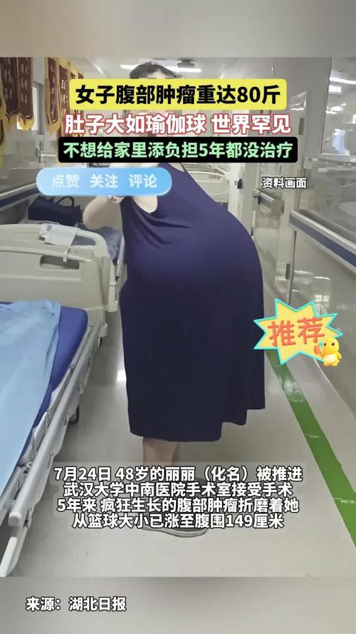 为了做手术，这位女子为何能减掉近百斤体重？