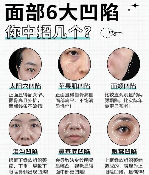 为什么我的面部特征与这4种如此吻合，竟成了我容易发胖的根源？