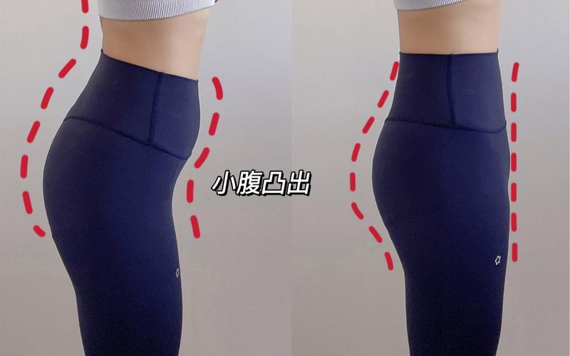 小腹凸臀下垂，是不是不良姿势导致的呢？