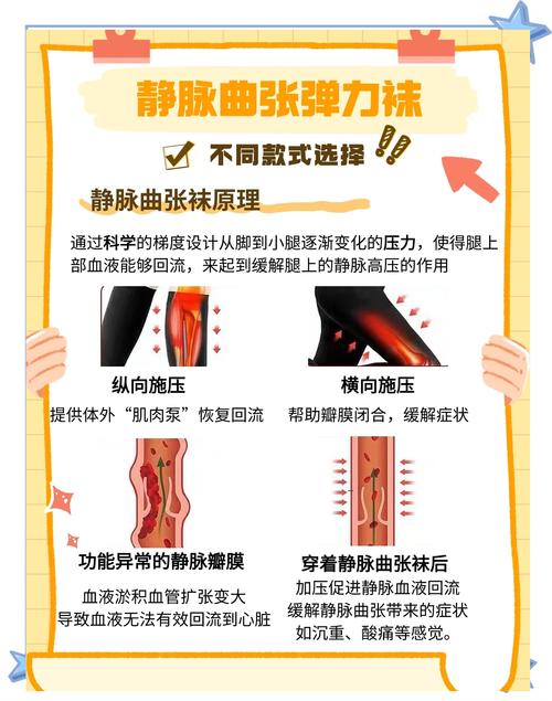 静脉曲张袜真的需要每天穿吗？还是存在其他小误区？