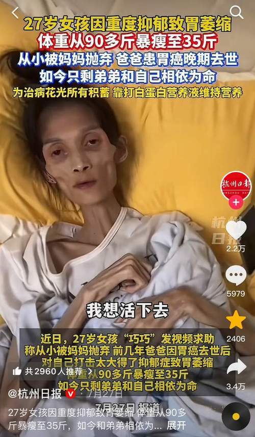 37岁女子减肥过度导致厌食症，骨瘦如柴无法行走，这是怎么回事？