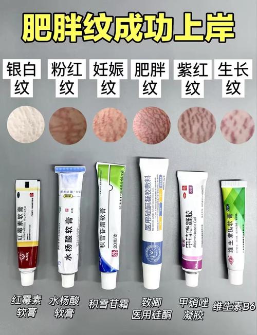 如何有效解决减肥后肥胖纹问题，直击根源？
