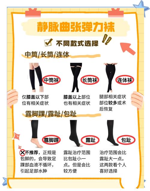 静脉曲张袜真的需要每天穿吗？还是存在其他小误区？