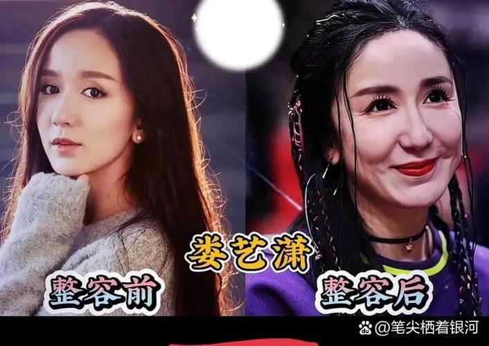 盘点大饼脸变锥子疑似整容的十大女星，她们真的整容了吗？