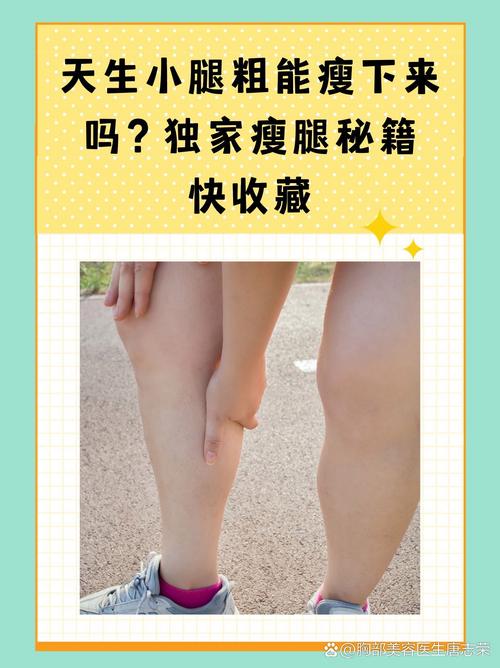 小腿循环不好是否会导致我肥胖？