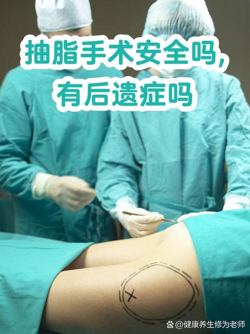 七旬老人做吸脂手术安全吗？适合减肥吗？