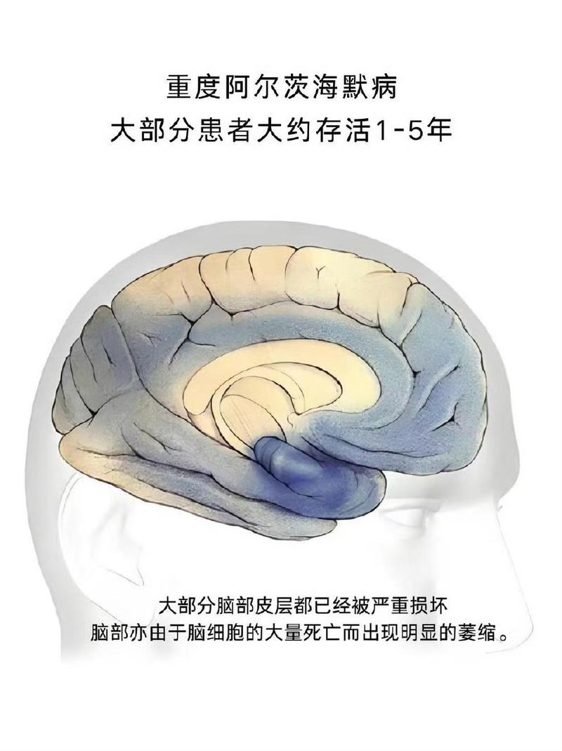 大脑中的恶魔是减肥失败的罪魁祸首吗？