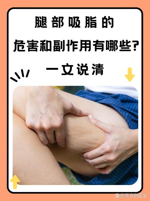 吸脂减肥后可能会出现哪些副作用？