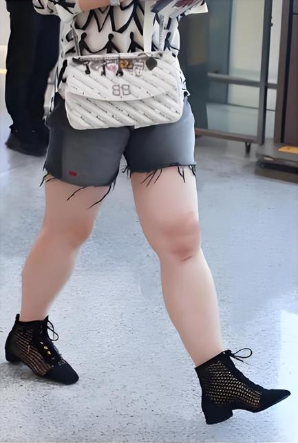 你难道不再嫌弃自己那大象腿，反而可嫩梗健康吗？