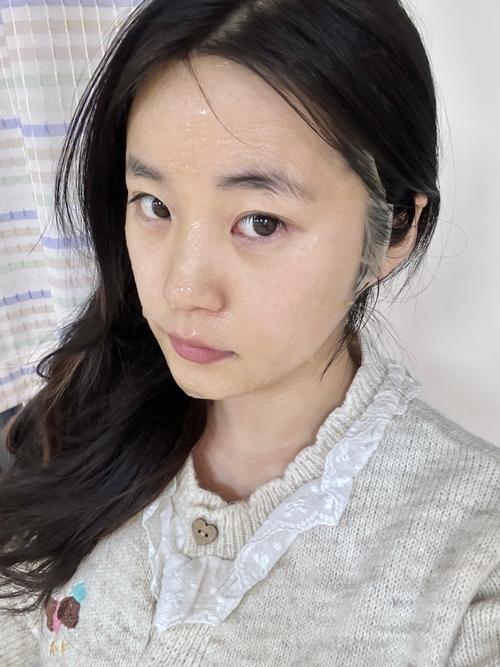 日本蕞美丽脸蛋如今满脸颗粒，是节食减肥导致的吗？