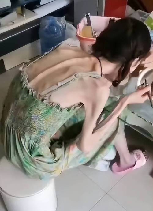 女孩减肥过度，变成骷髅般可怕，这是怎么回事？