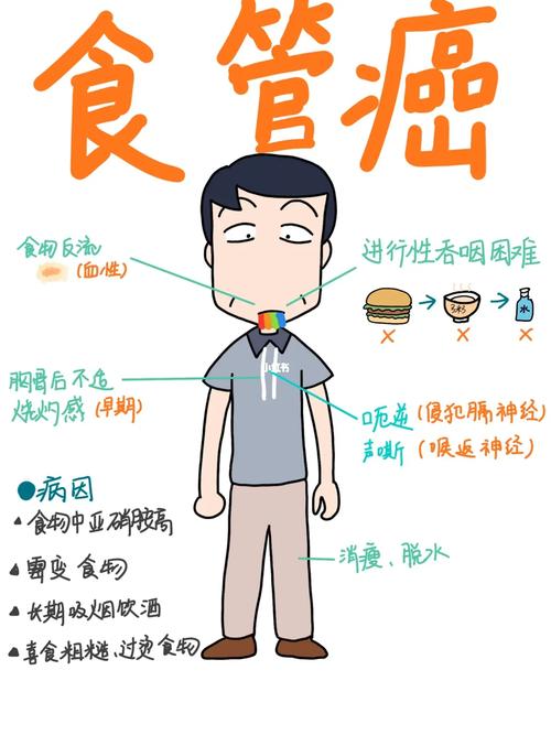 肥胖患者为何更容易患上食管癌呢？这是否与某些研究有关？