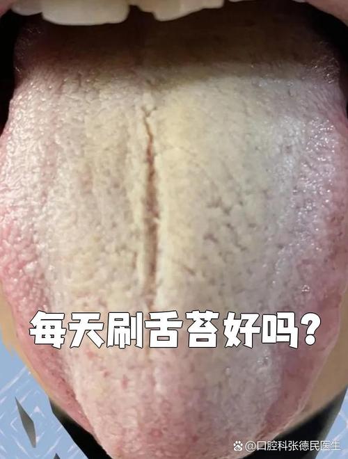早晨刷舌头能控制一天食欲吗？