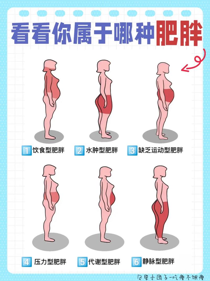 水肿型肥胖的成因有哪些详细分析？