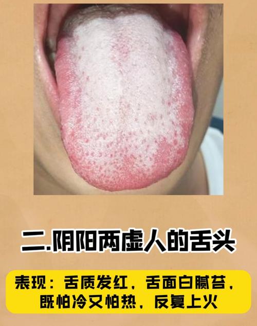 热炒舌苔减肥法真的靠谱吗？别被误导了！
