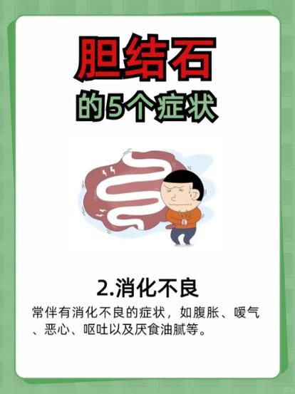 为什么肥胖女性更容易患上胆结石？