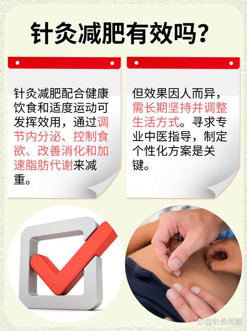 针灸减肥有哪些科学要领才能做到健康减肥呢？