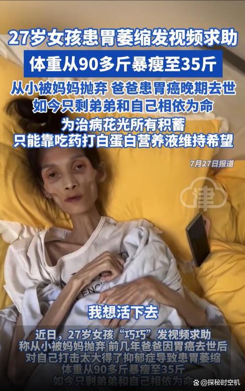 女子暴瘦变活骷髅，揭秘哪些害人减肥法让人担忧？