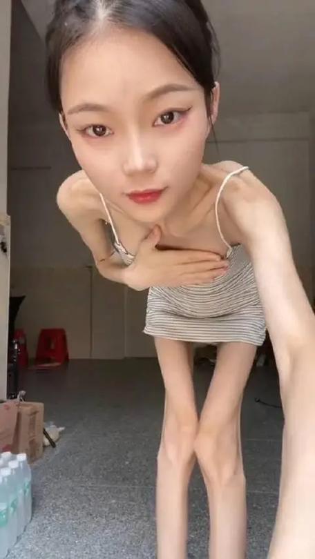 20岁女孩不当减肥后变成弱智，这是真的吗？