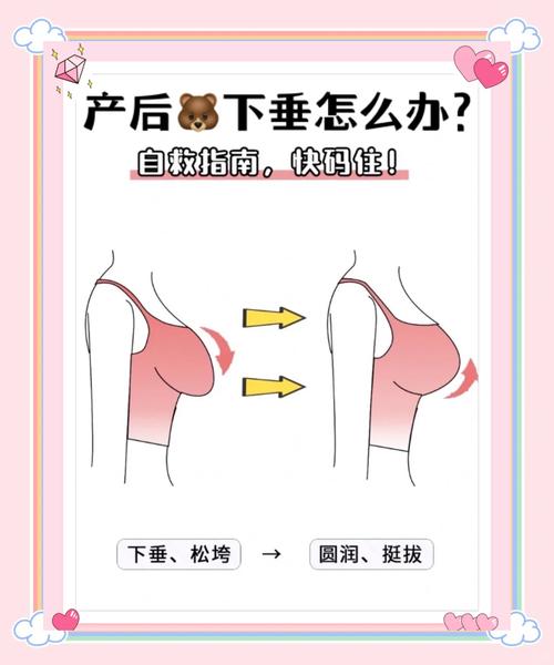 产后如何避免胸下垂，塑身专家有哪些专业建议？