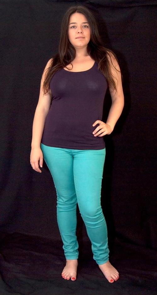 这位英国女子双腿重达70公斤，是常人的3倍粗，这是怎么回事呢？