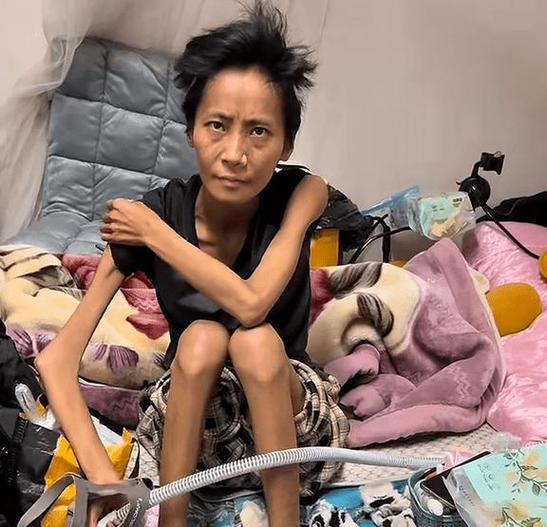 骨瘦如柴的人减肥后真的容易患上可怕的疾病吗？