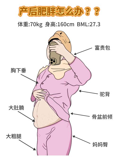 产后肥胖有几种类型？我属于哪一种肥胖类型？